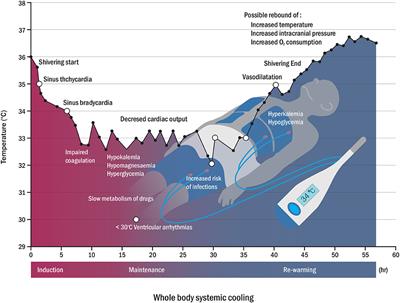 Selective Brain Cooling: A New Horizon of Neuroprotection